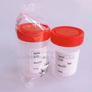 Urine Container