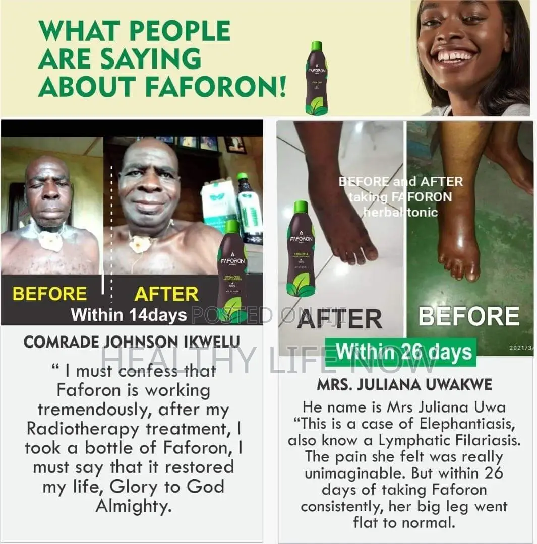 Before and After Taking Faforon Organic Solution