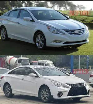 Car Face Kit for Hyundai 2011 2015 Sonata Upgrade to 2016