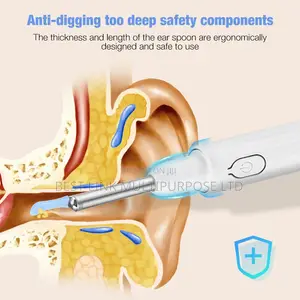 Wireless Smart Otoscope/Camera/Visible Ear Cleaner
