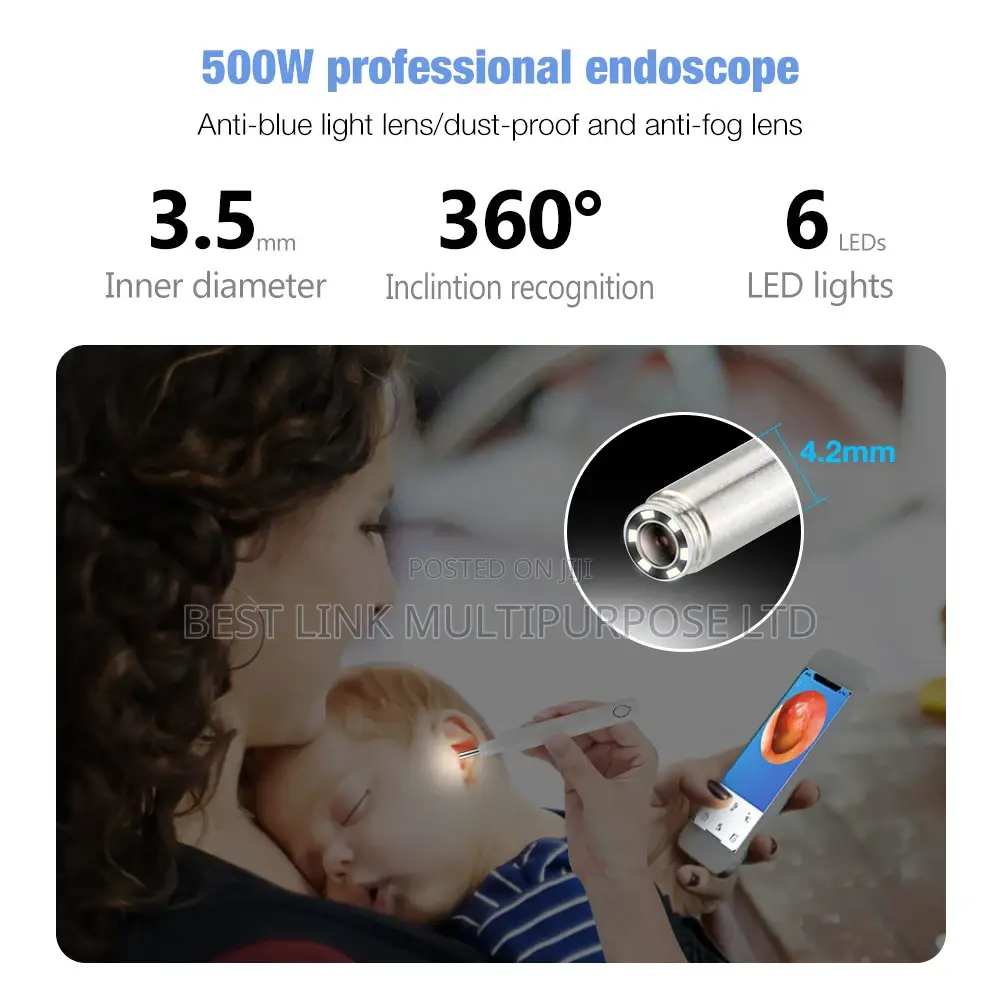 Wireless Smart Otoscope/Camera/Visible Ear Cleaner