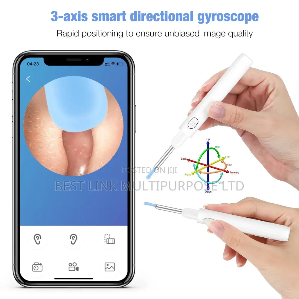 Wireless Smart Otoscope/Camera/Visible Ear Cleaner