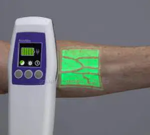Vein Location Device