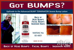 Bump Terminator- Anti Bump Lotion- 120ml - Resellers