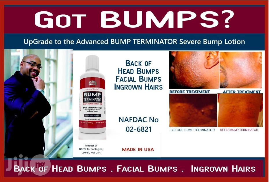Bump Terminator- Anti Bump Lotion- 120ml - Resellers