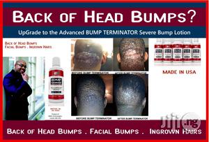 Bump Terminator- Anti Bump Lotion- 120ml - Resellers