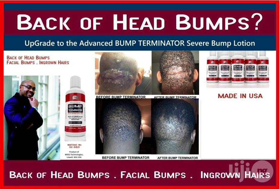 Bump Terminator- Anti Bump Lotion- 120ml - Resellers