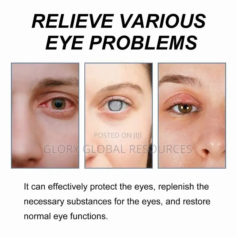 Ximonth Eye Problem Solution Drop