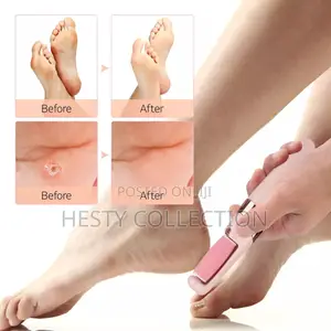 Dead Skin Callus Remover Pedicure Tool Rechargeable Grinder