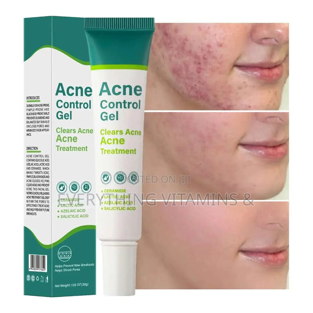 Acne Control Gel With Azelaic, Salicylic Lactic Acid Etc