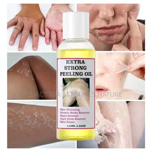 Peling Oils