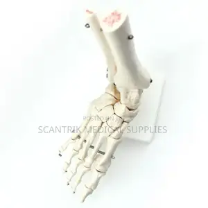 Ankle Joint