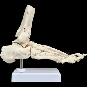 Tibiotalar Joint