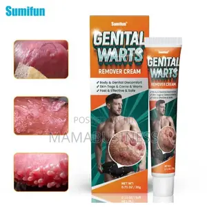 Sumifon Genital Wart Removal Cream-20g
