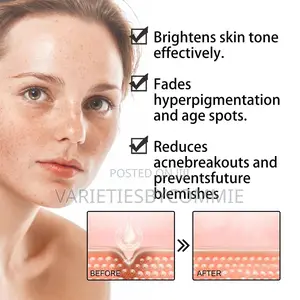 Eelhoe Facial Brightening Serum