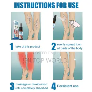 Varicose Veins