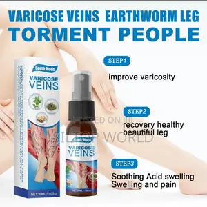 Varicose Veins
