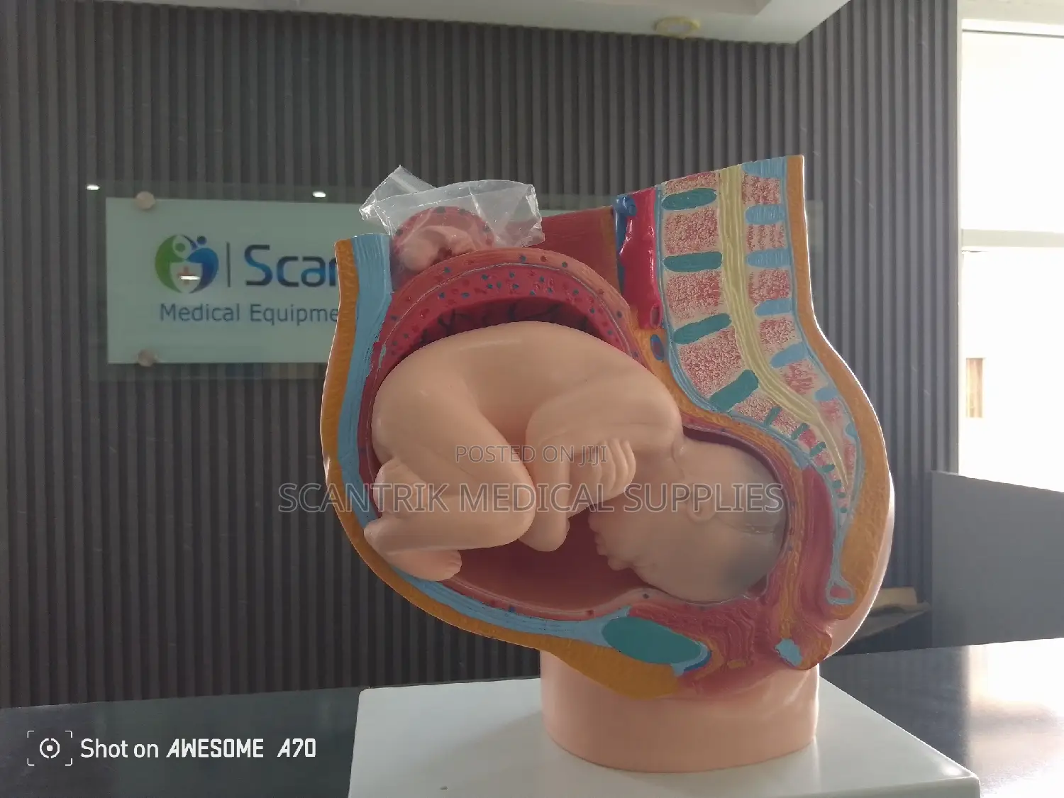 Pregnancy Model