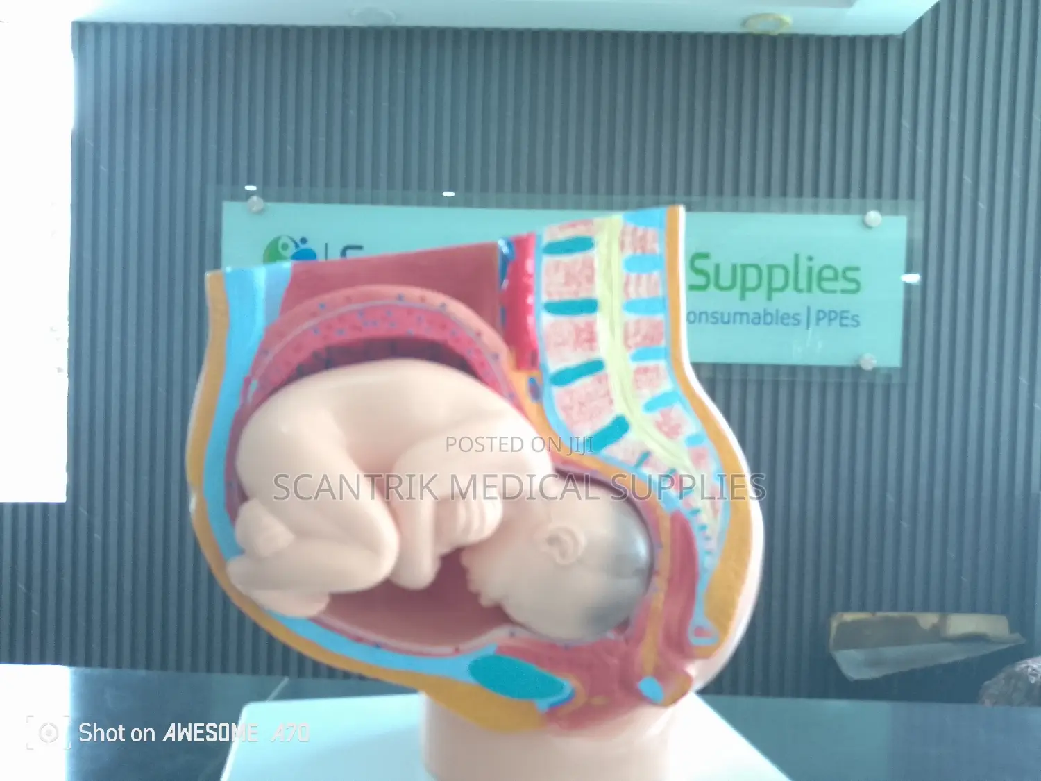 Female Pelvis Model