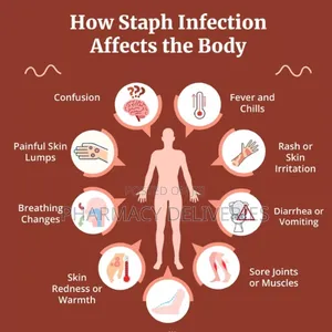 Treatment for Staphylococcus Aureus (Staph Infection)