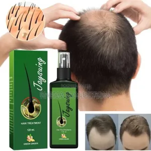 Jasuing Ginger Germinal Hair Growth Treatment Spray (120ml)