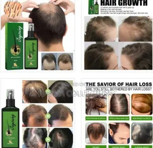 Jasuing Ginger Germinal Hair Growth Treatment Spray (120ml)