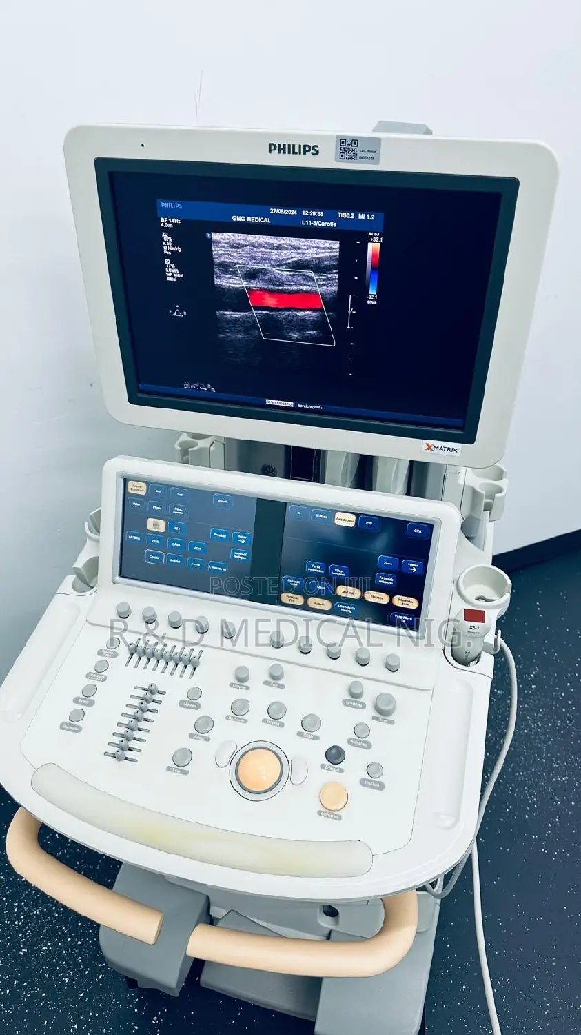 Ultrasound Scan Machine
