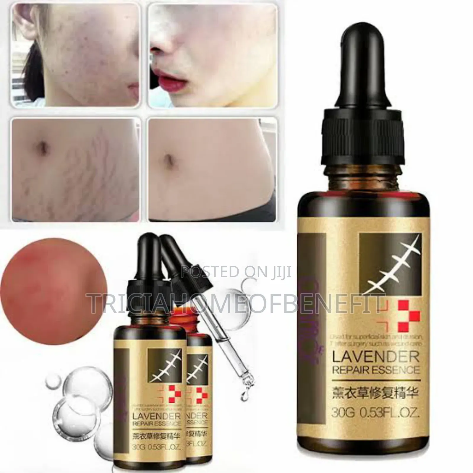 Lavender Stretchmark Removal Oil