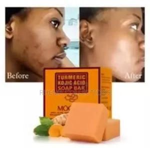 Turmeric Kojic ACID Bar Soap