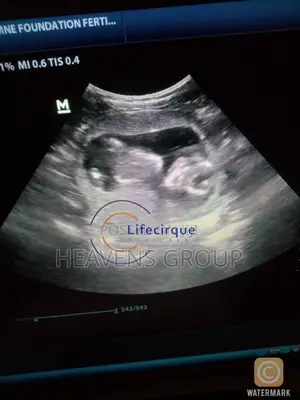 Ivf Surrogacy at Discounted Rates in Nigeria - Lifecirque