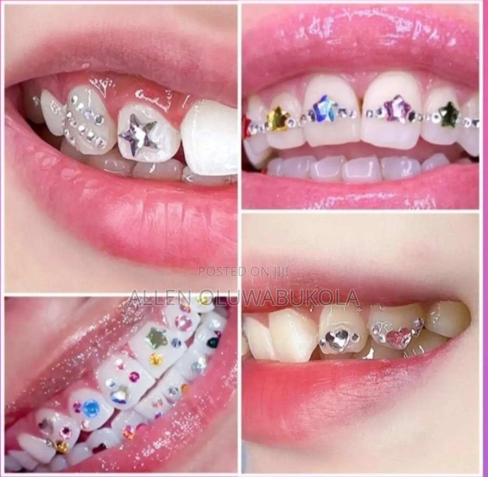 Tooth Gem KIT