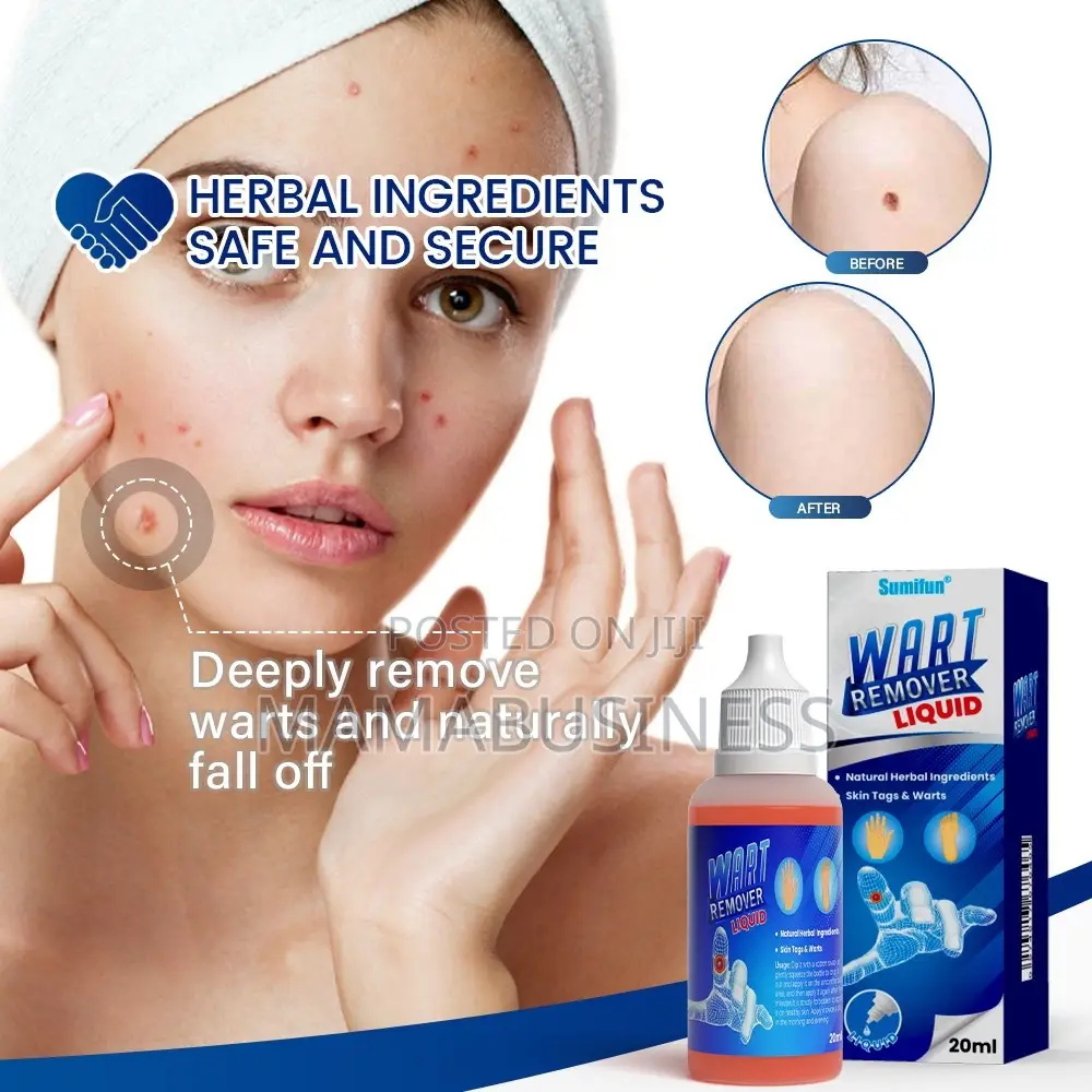 Sumifun Wart Remover Liquid-20ml