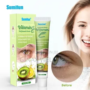 Vitamin E Fat Granules Removal Cream