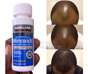 Kirkland Signature Minoxidil Hair Regrowth Solution - 60ml