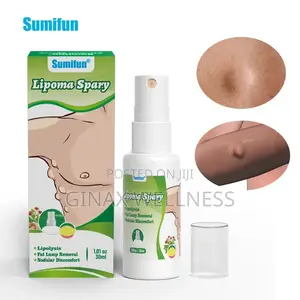 Lipoma Spray |Topical Spray For Skin Lump And Benign Lipoma
