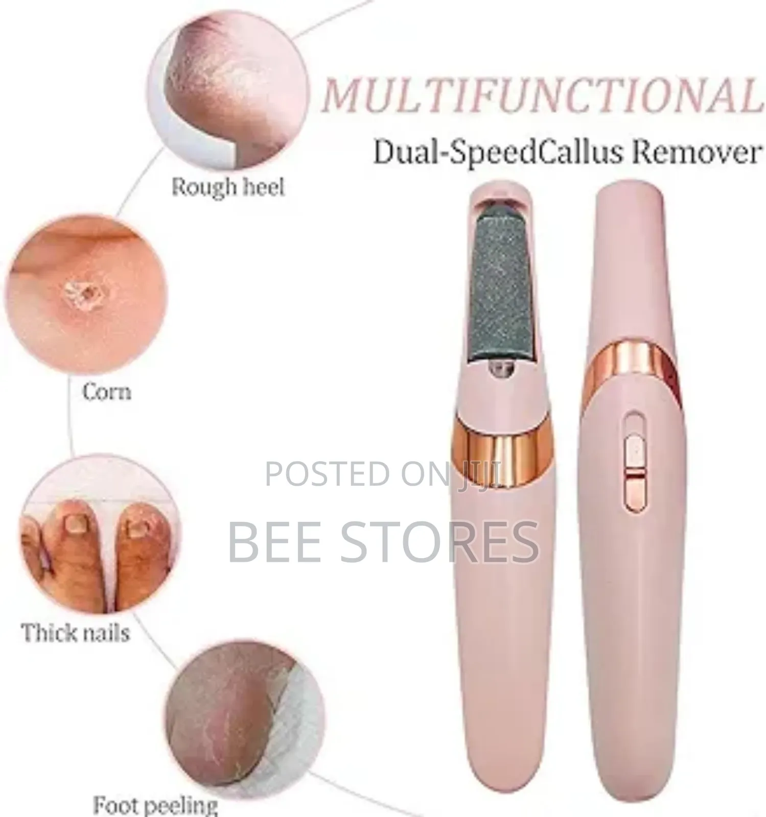 Callus Remover