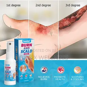 Burn and Scald Spray
