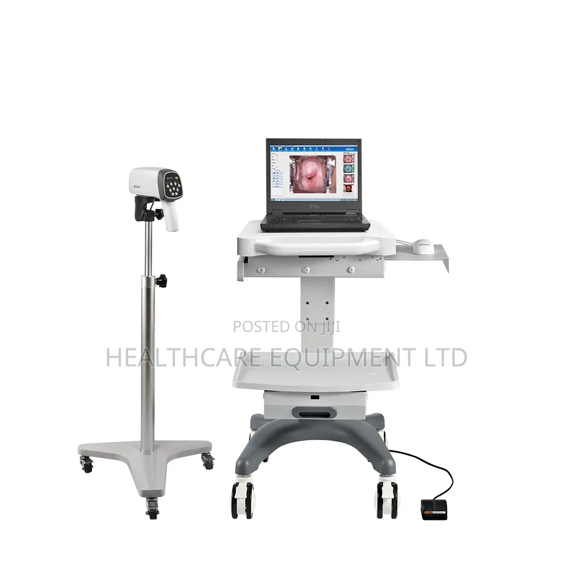 Edan C6 Video Colposcope