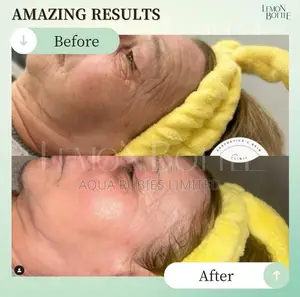 Lemon Bottle Skin Booster