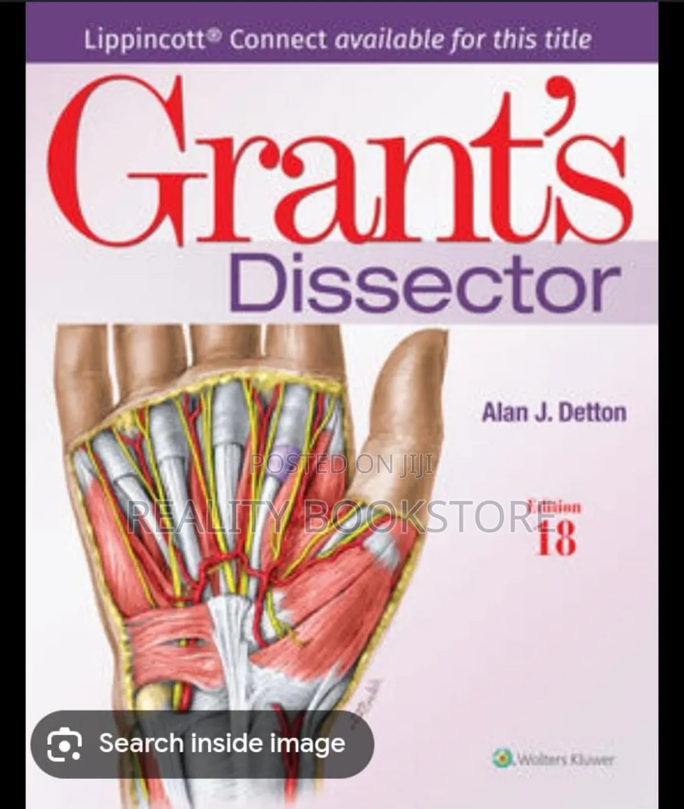 Grant Dissector