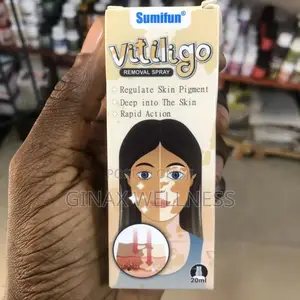 Vitiligo Removal Spray
