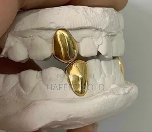 Pure Italian 18karata Gold Teeth