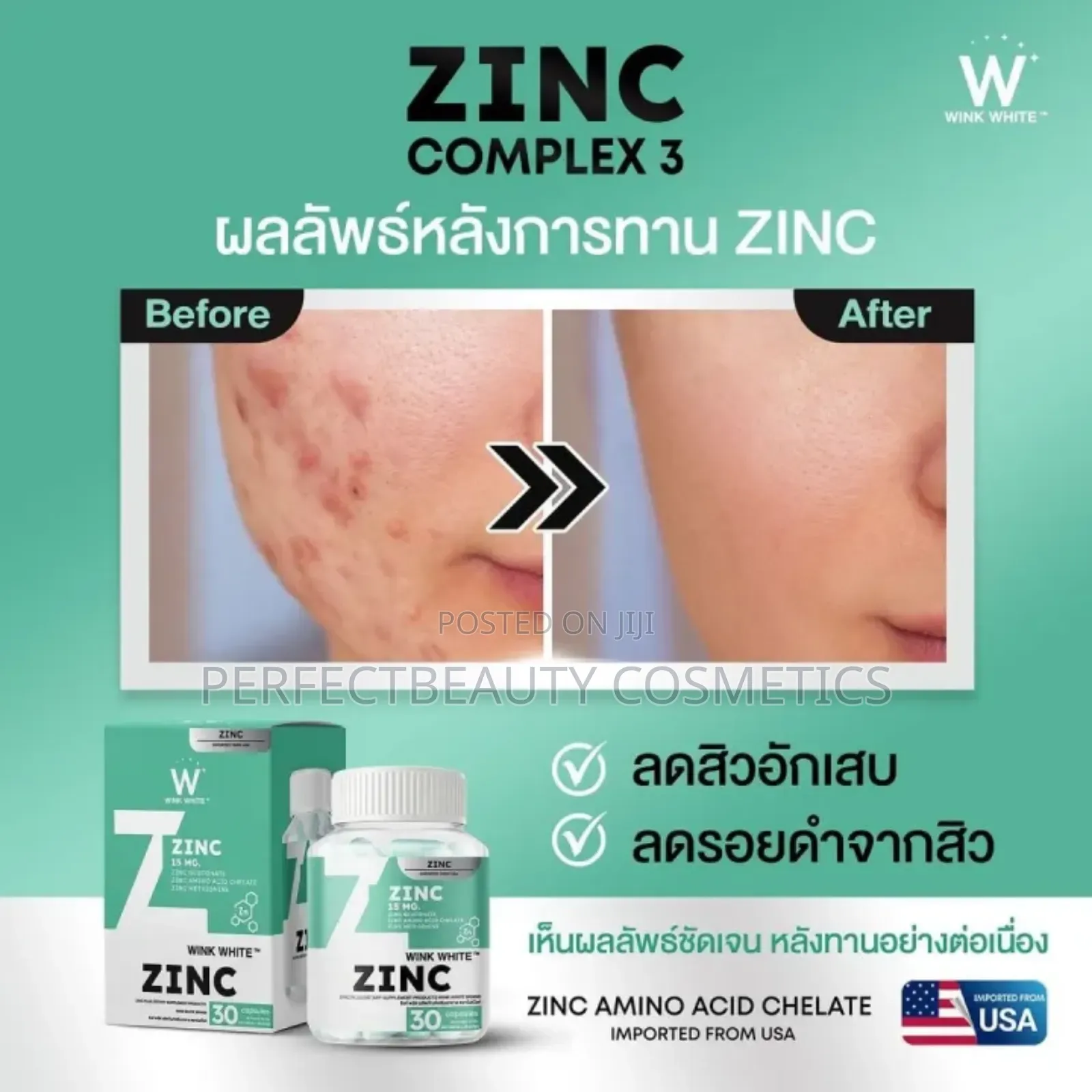 Wink White Zinc Complex 3