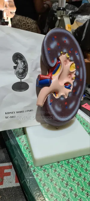Kidney Model