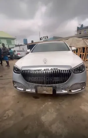 Mercedes-Benz E300,E400 2017 Upgrading Kits to 2023