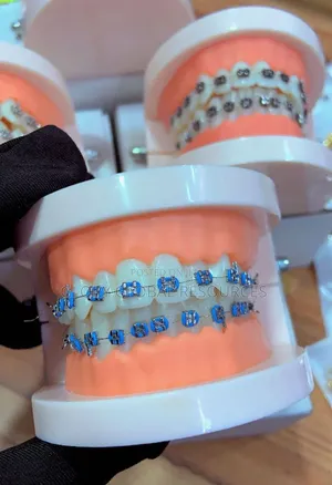 Teeth Braces - FASHIONABLE