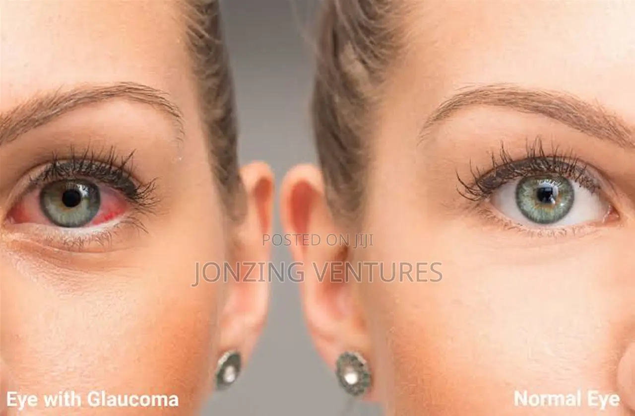 No More Blurry Vision With Eelhoe