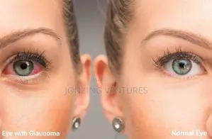 No More Blurry Vision With Eelhoe