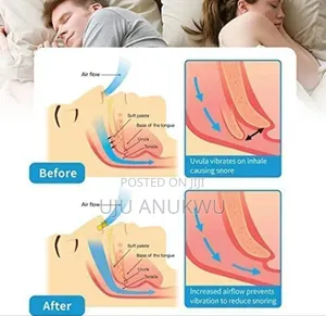 2 In 1soft Silicon Anti Snoring Magnetic Nose Plug