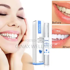 EFERO Teeth Whitening Pen